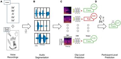 Machine-learning assisted swallowing assessment: a deep learning-based quality improvement tool to screen for post-stroke dysphagia
